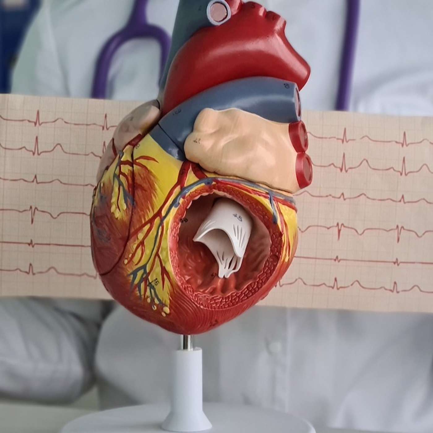 Left ventricular suction, stiffness and heart failure