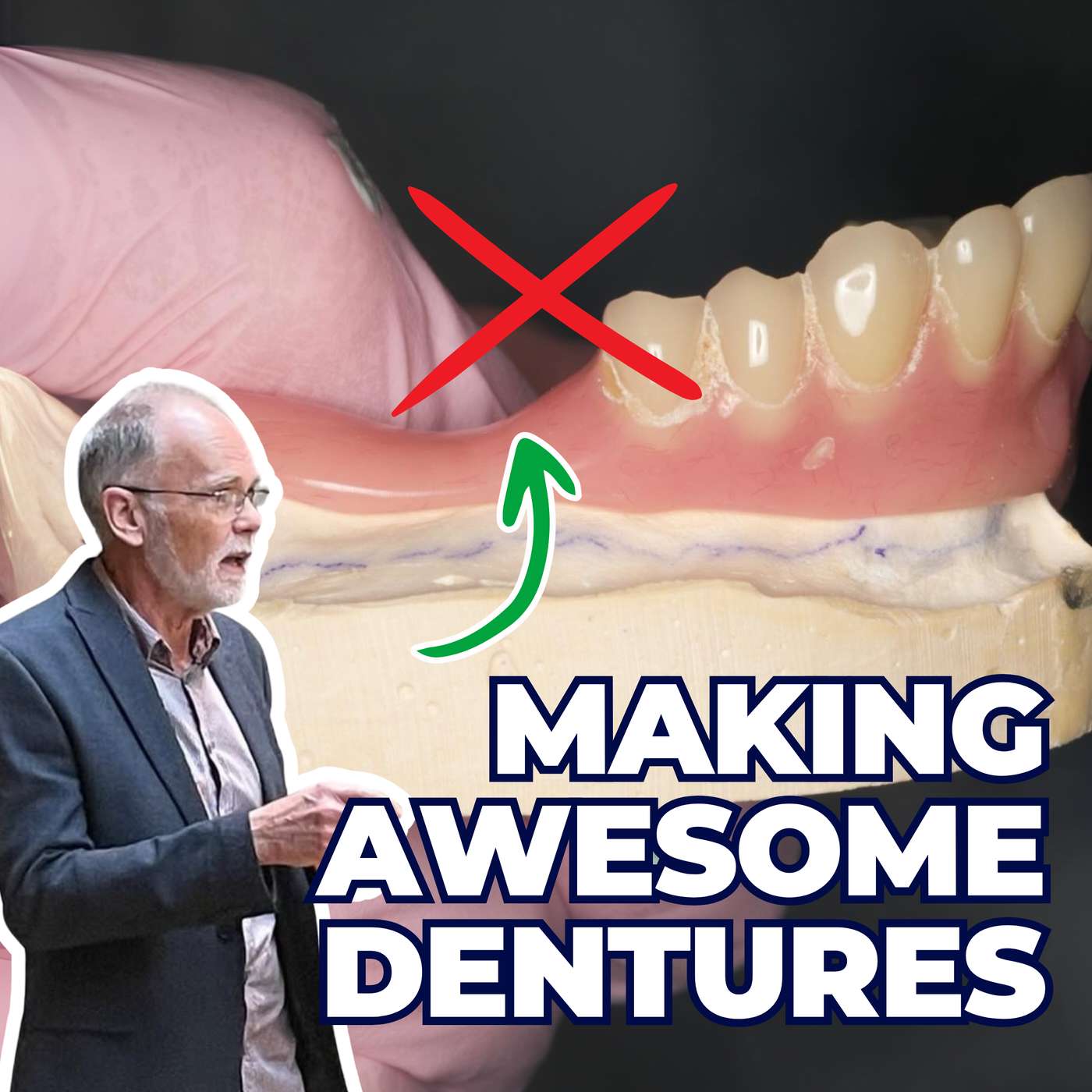 Making Awesome Dentures – Border Moulding and Beyond – PDP205 episode artwork