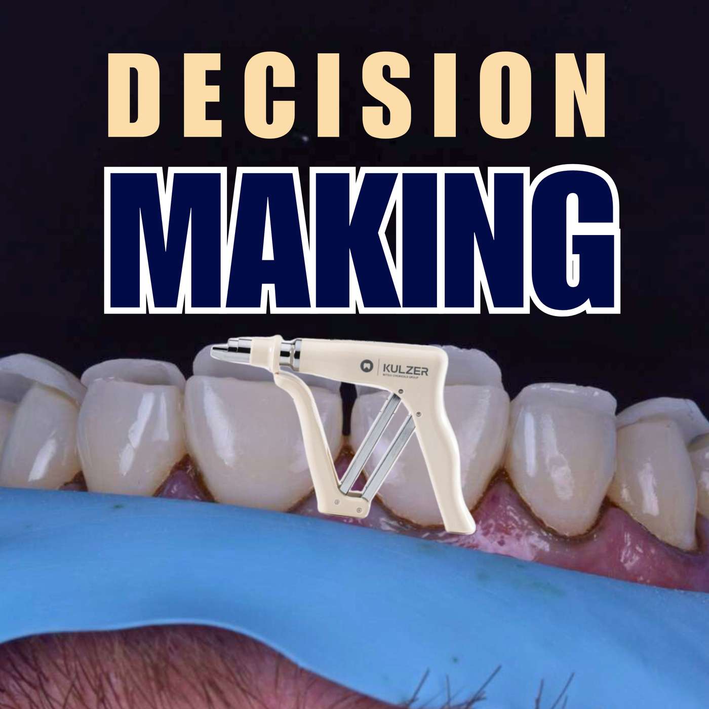 Decision Making for Anterior Composites – PDP211 episode artwork
