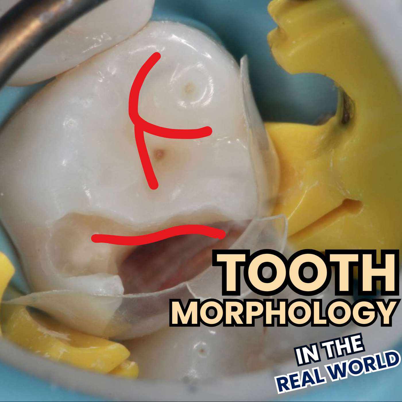 Should our Restorations Follow Textbook Anatomy? Tooth Morphology – PS005 episode artwork