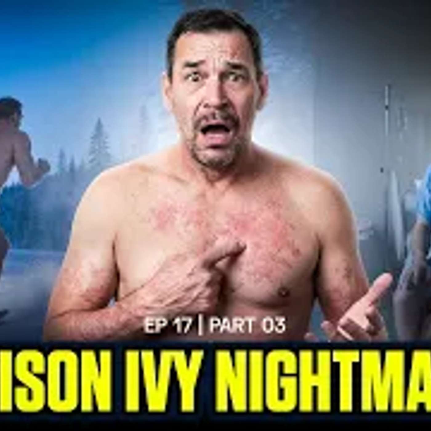 Poison Ivy On My Junk & Life After Losing An Arm | Beer, Booze & B.S.| Ep. 17 Pt. 3|