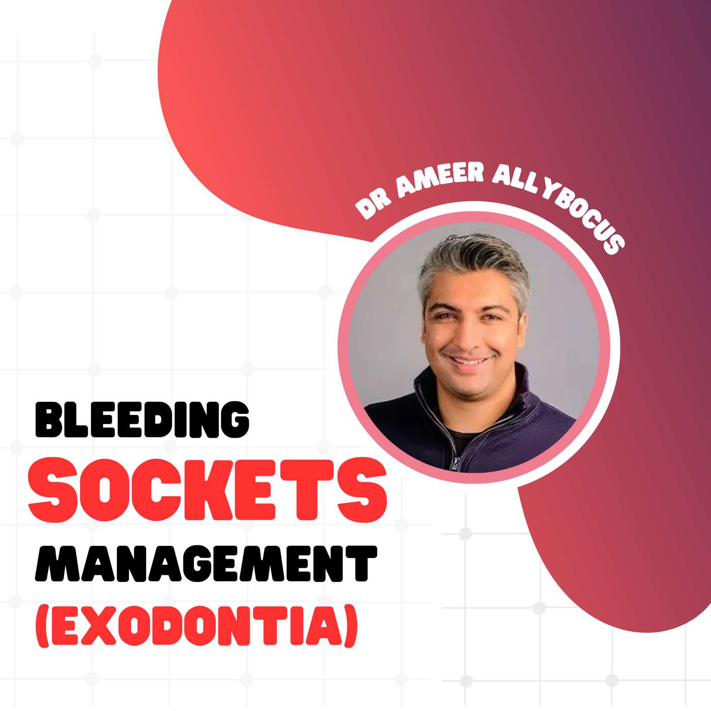 Bleeding Sockets Management CLINICAL Exodontia – PDP166 episode artwork
