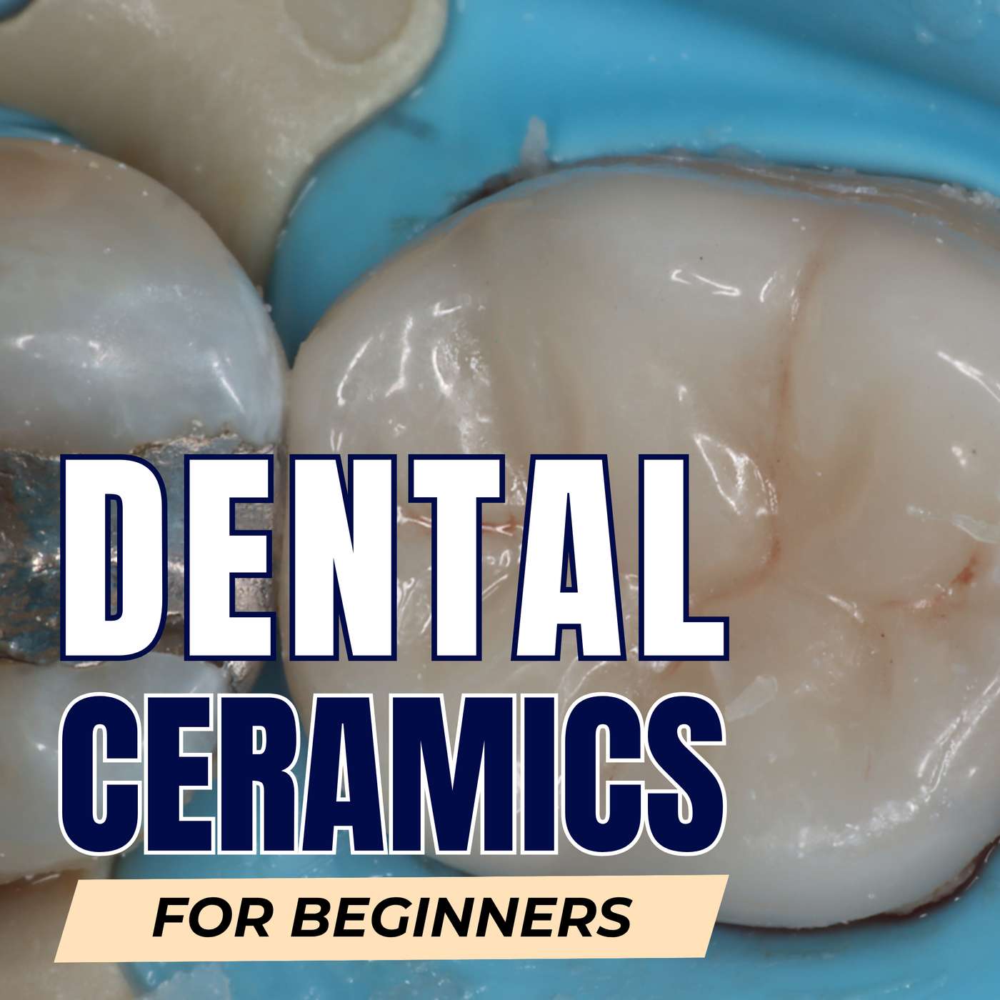 Dental Ceramics for Absolute Beginners – PS013 episode artwork