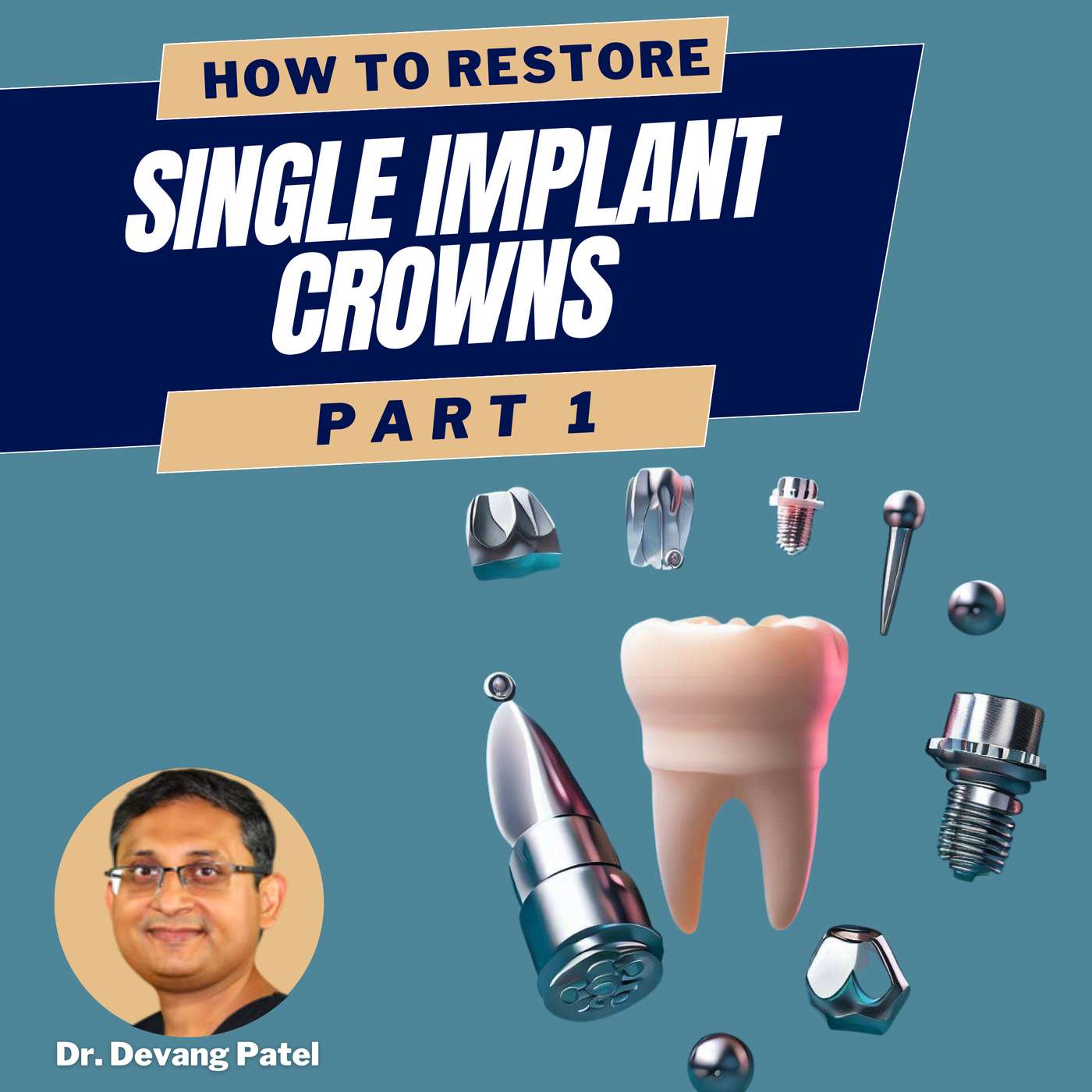 An Idiot’s Guide to Restoring Single Implant Crowns (Part 1) – PDP156 episode artwork