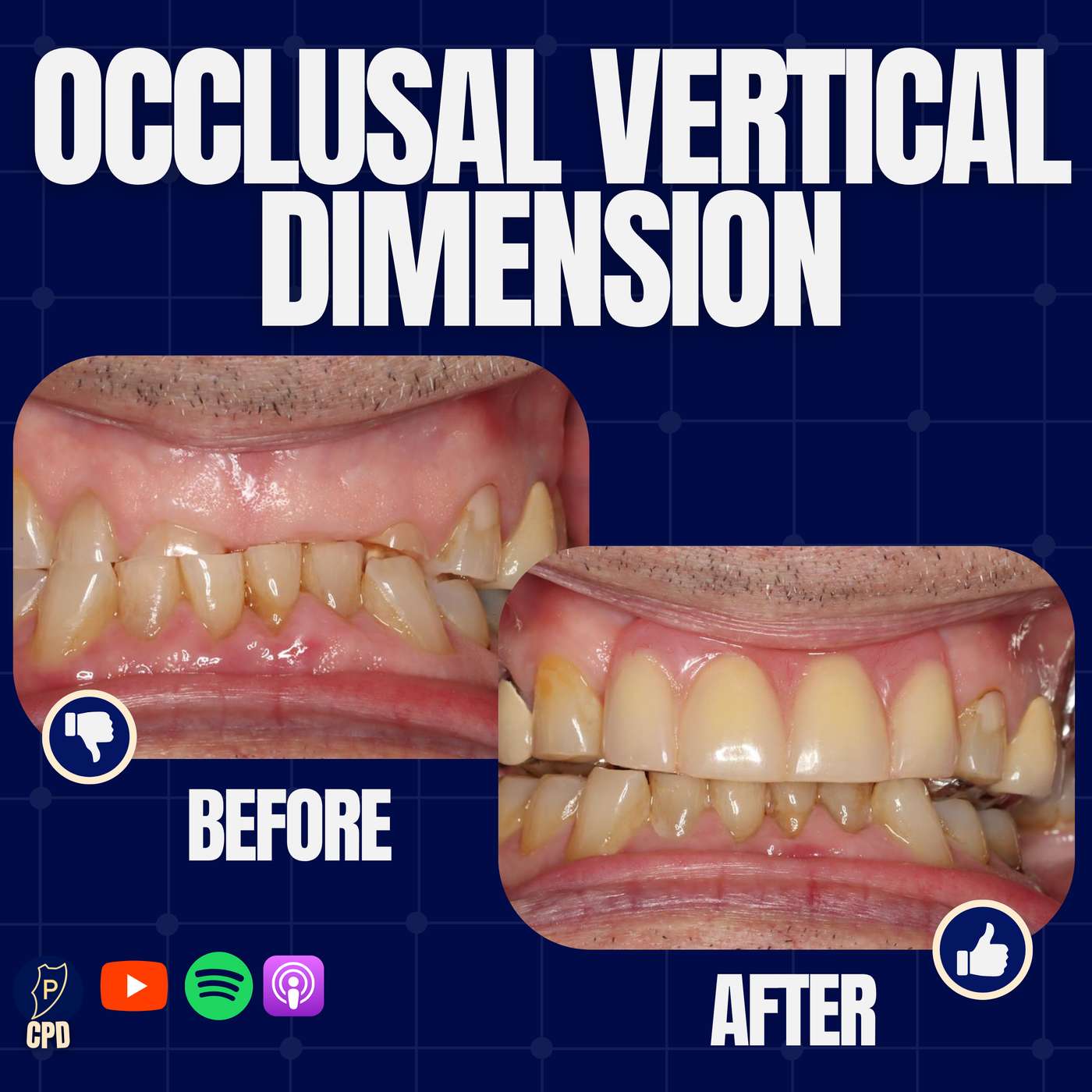 [OCCLUSION MONTH] Vertical Dimension – Don’t Be Scared! – PDP197 episode artwork