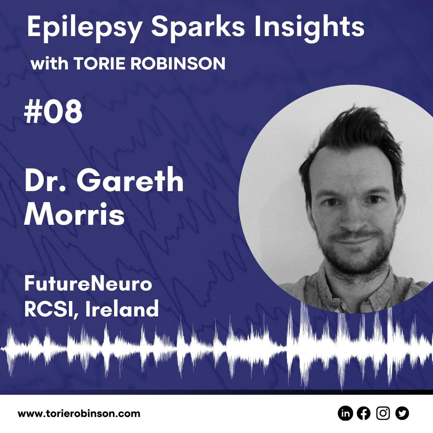 Temporal lobe epilepsy research from a scientist, epilepsy researcher & editor - Dr. Gareth Morris episode artwork