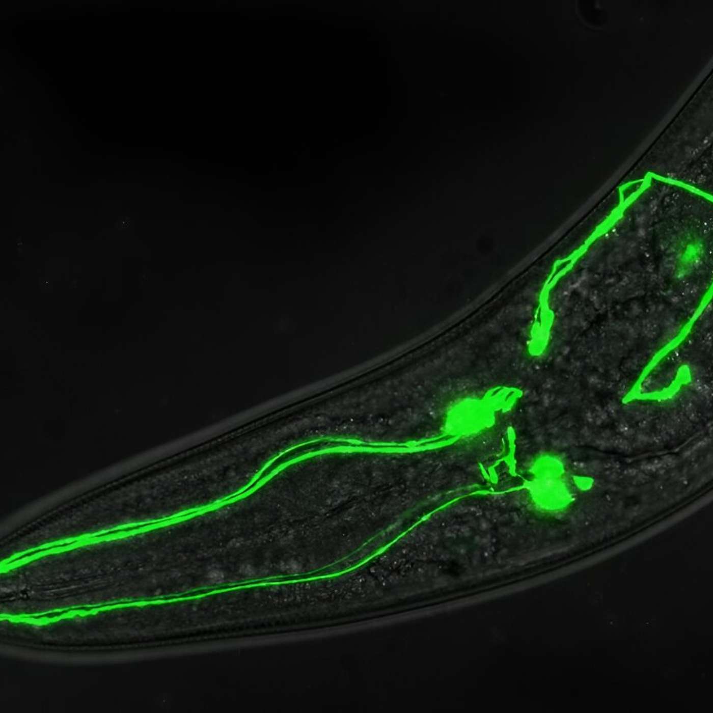 Couple Discovered in Pompeii, Tablet Use Linked to Tantrums, Transparent Worms Reveal Dopamine Secrets, Breakthrough in Pediatric Brain Cancer, and more...