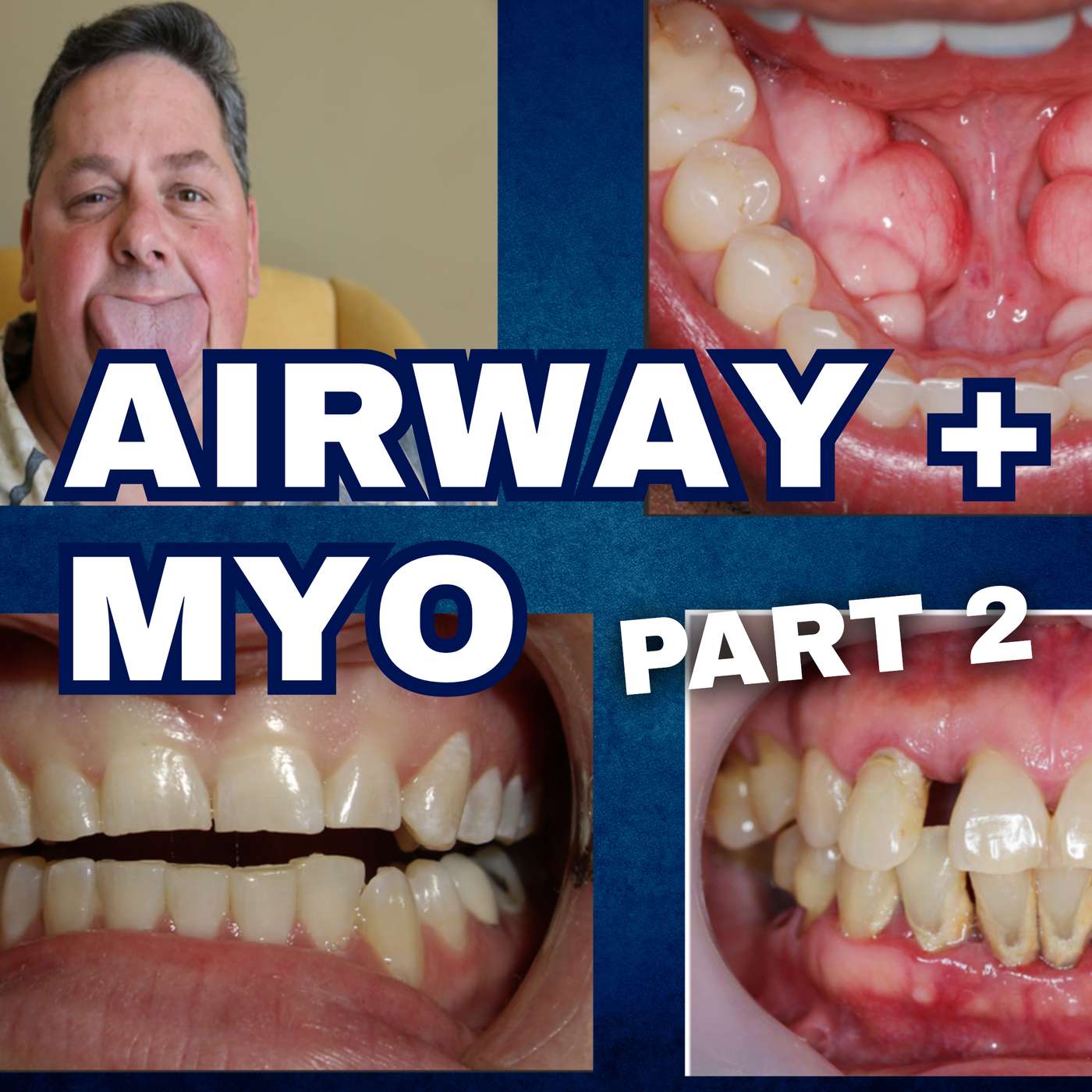 Implementing Sleep, Airway and Myo to Restorative Dentistry Part 2 – PDP263