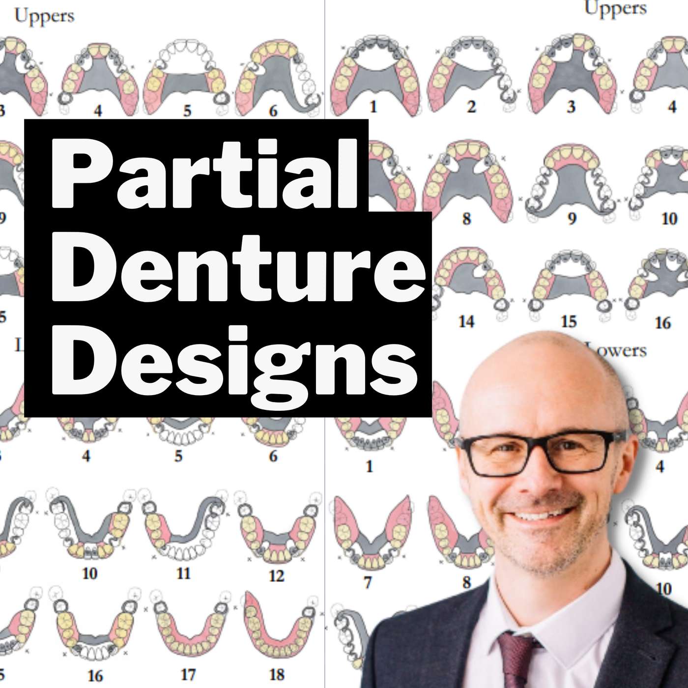 Chrome Partial Dentures Guide – The Scandinavian Way – PDP134 episode artwork