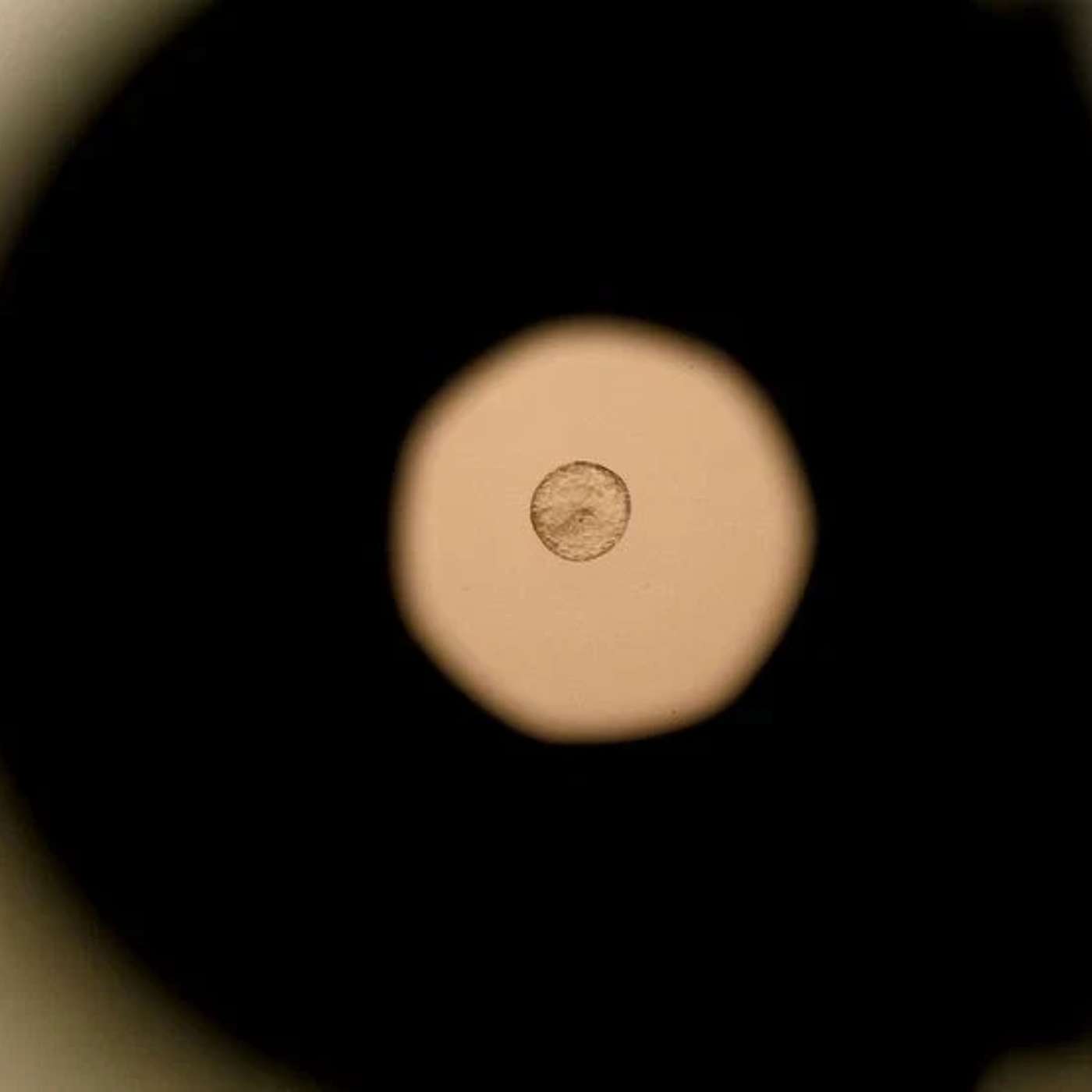 New Insights from Elephant DNA, Stanford's Milli-Spinner Revolutionizes Stroke Treatment, Mastodons Vital for Chilean Forests, Vaccine Preparedness at Risk, and more...