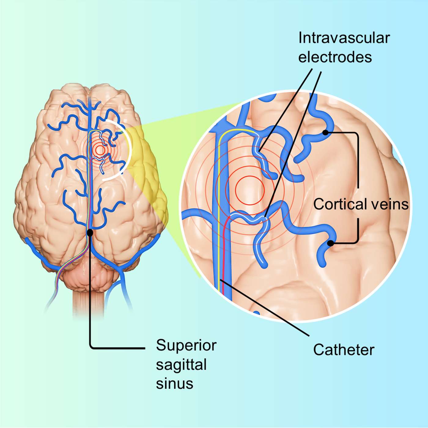 GC Biopharma Advances mRNA Vaccine, Innovative Brain Monitoring Technique, Daratumumab Boosts Myeloma Survival, Scientists Develop Lyme-Resistant Mice, and more...