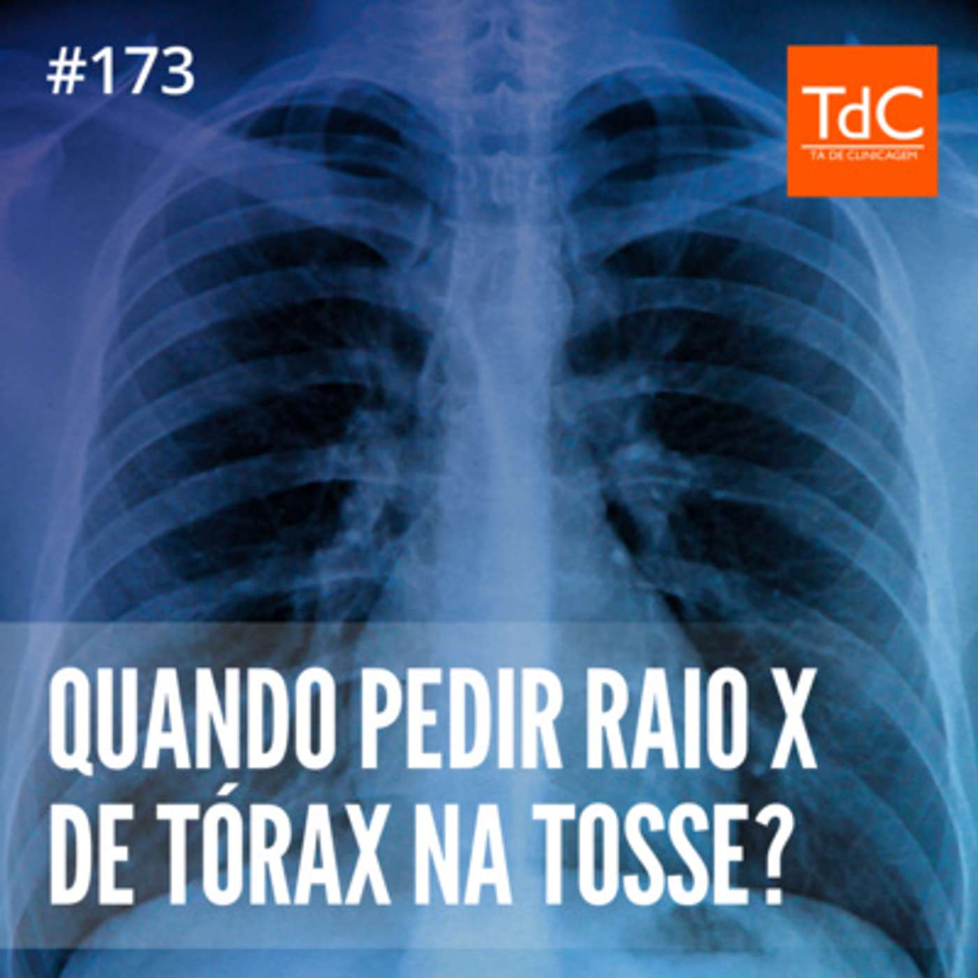 TdC 173: Quando pedir radiografia de tórax na tosse?