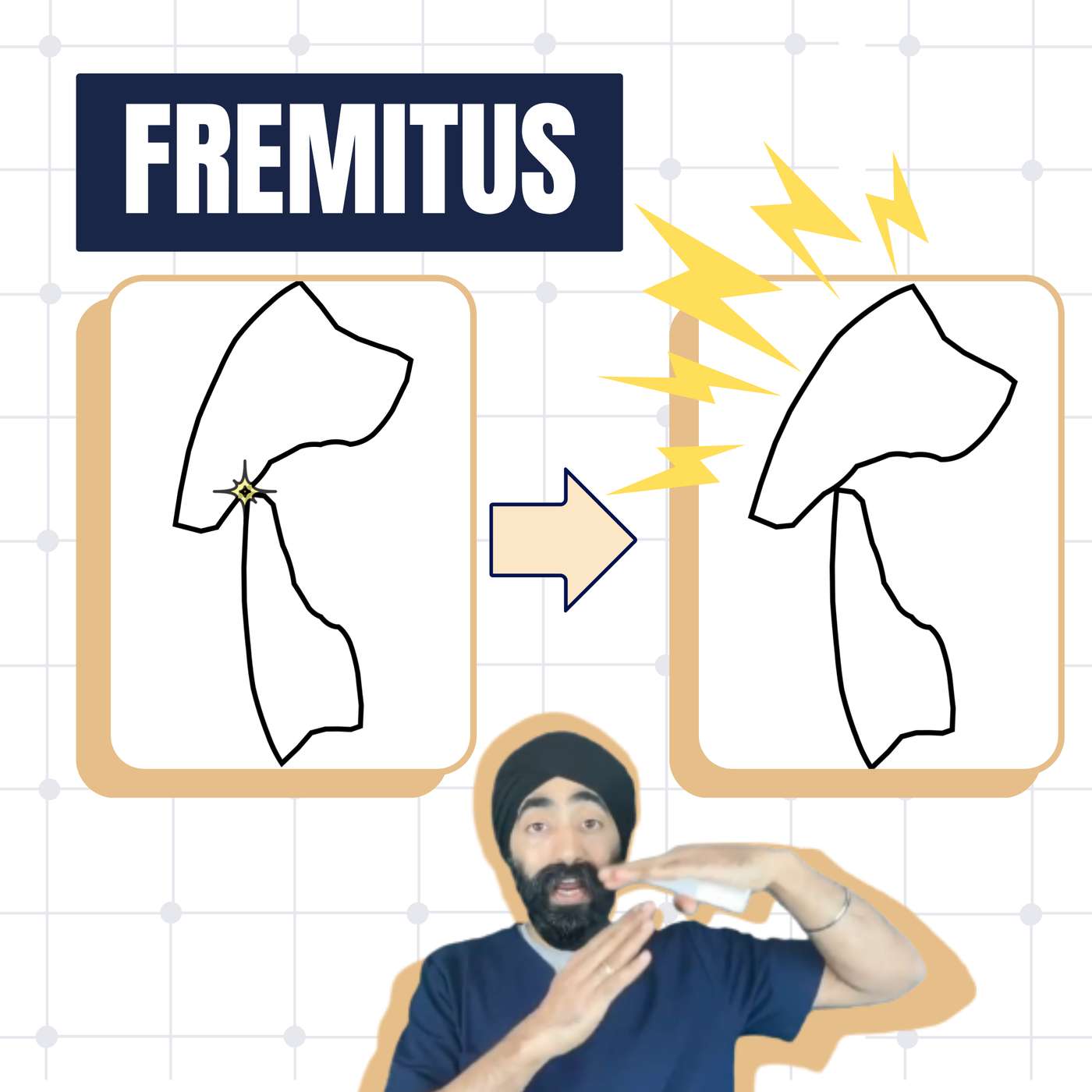 Fremitus and Occlusal Overload – Dental Occlusion Geekiness – PDP160 episode artwork