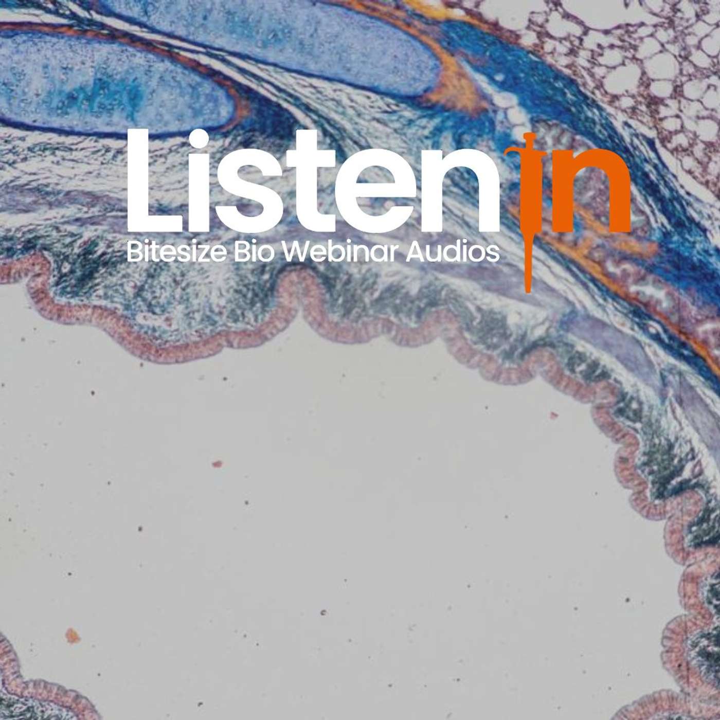 Unleashing Fibrotic Secrets: Coupling the Power of Laser Microdissection with Mass Spec Unleashing Fibrotic Secrets: Coupling the Power of Laser Microdissection with Mass Spec