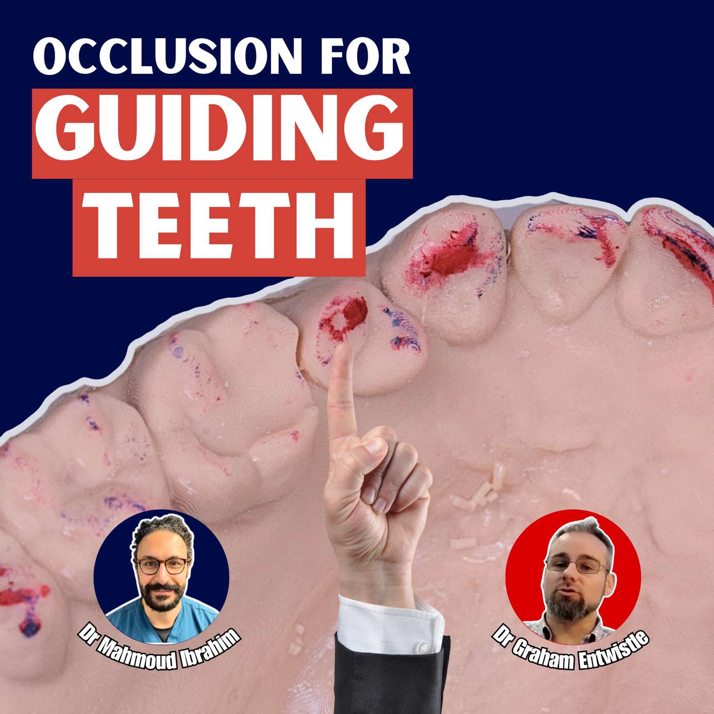 [Occlusion Month] Indirect Restorations For Guiding Teeth – PDP196 episode artwork