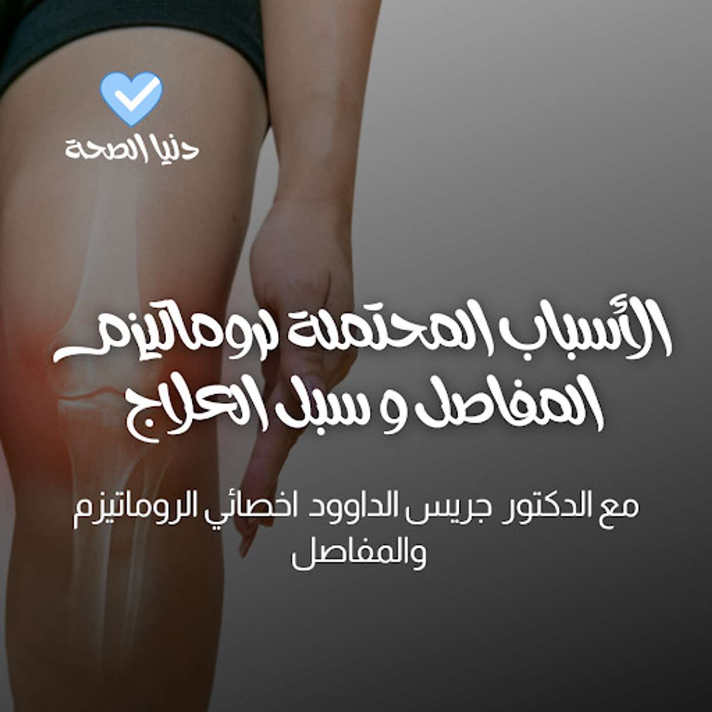 الكشف عن الأسباب المحتملة لروماتيزم المفاصل