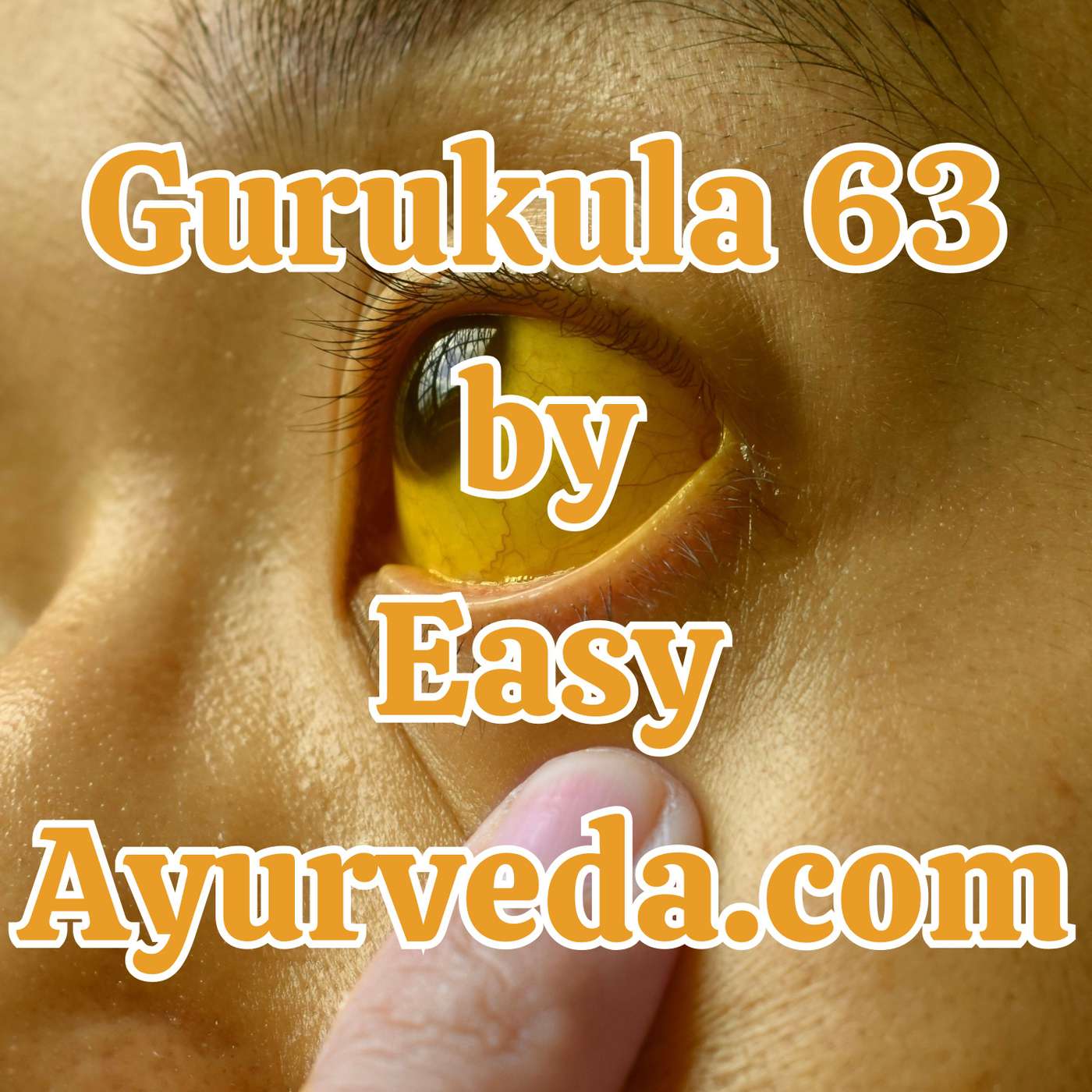 Gurukula 63: “Treatment of Jaundice in Ayurveda” episode artwork