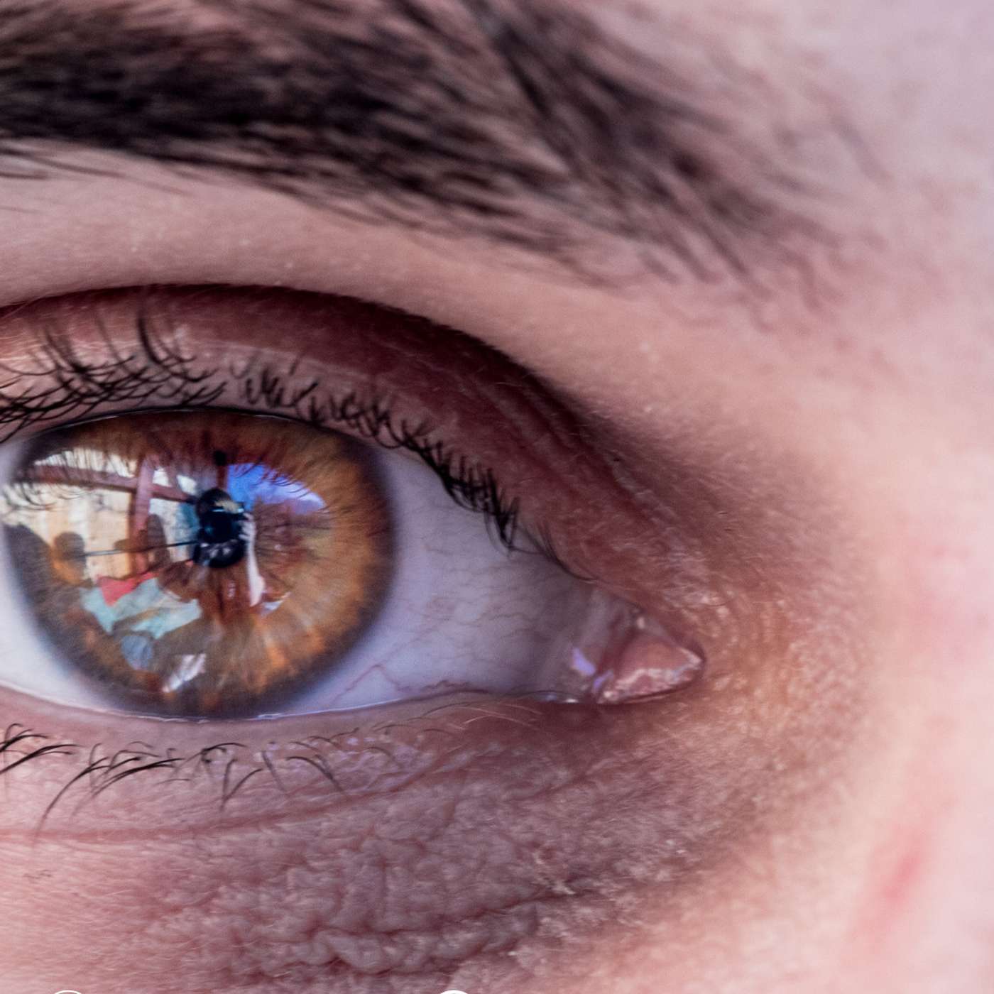 الهالات السوداء