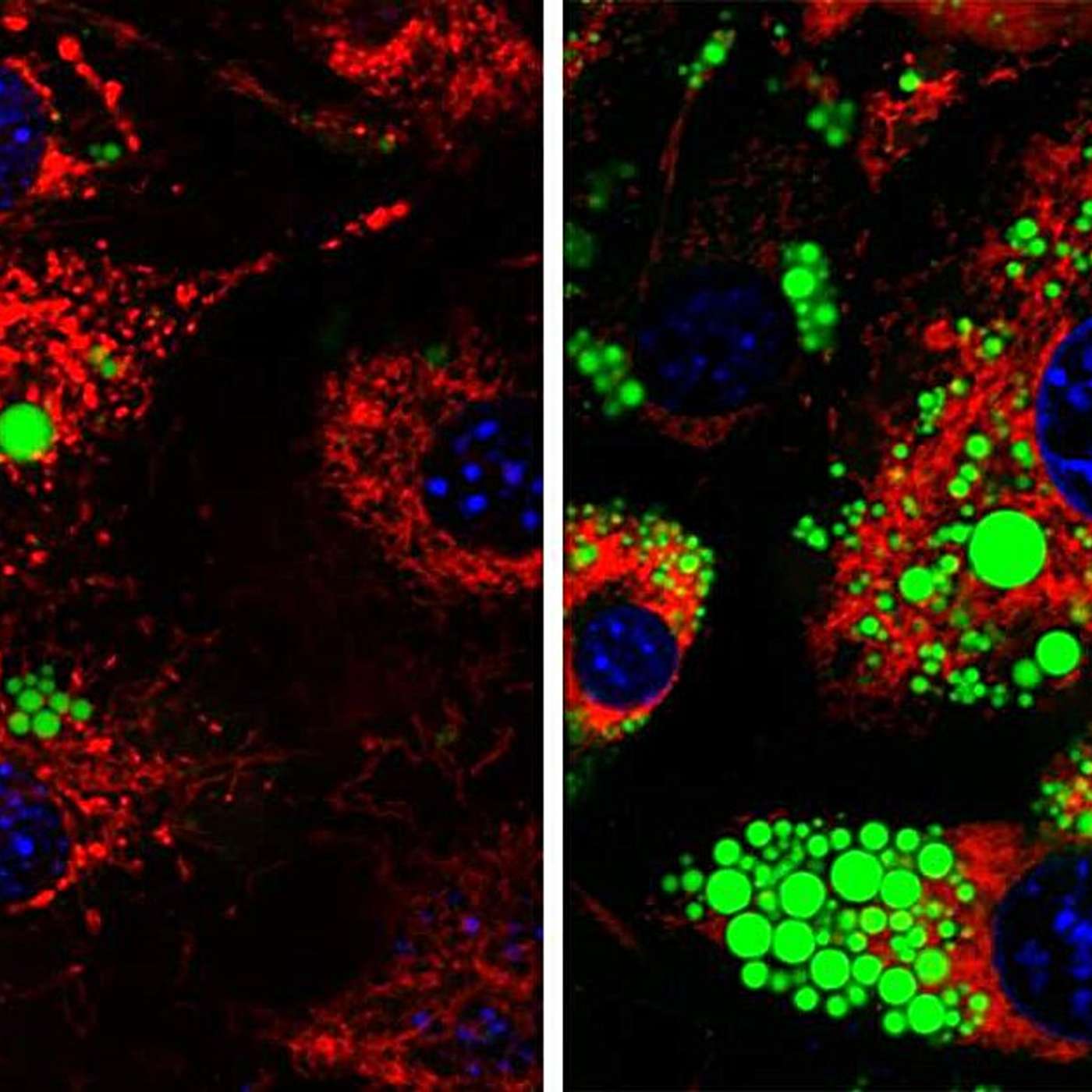 MIT Unveils New TB Diagnostic, New Protein Boosts Metabolism, Generative AI Transforms Mitochondrial Research, Scribe Therapeutics Unveils CRISPR Data, and more...