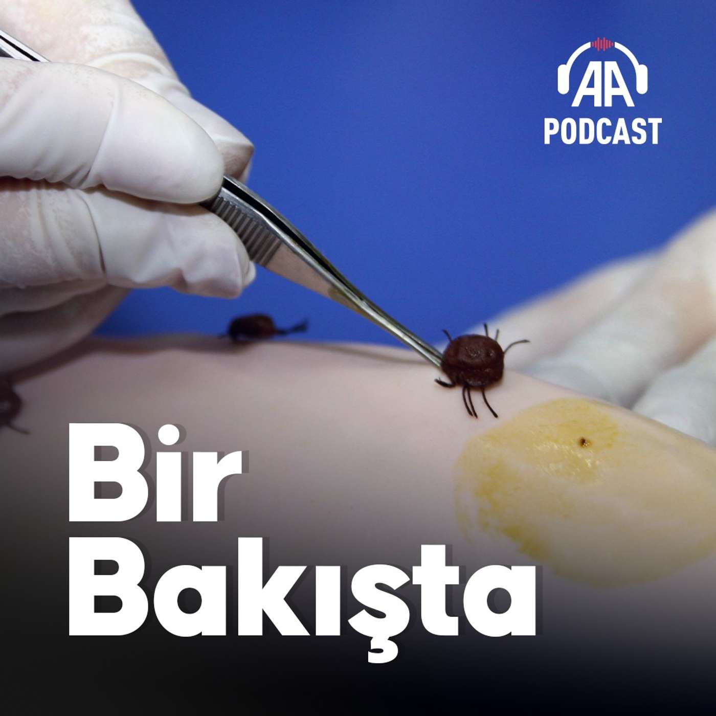 Kene vakalarında nelere dikkat edilmeli?