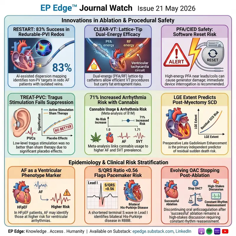 EP Edge™ Journal Watch Issue 21 May 2026: AI-Guided AF Ablation, PFA/CIED Safety, VT Ablation, Cannabis and Arrhythmia Risk, HCM, HFpEF, RBBB, and Anticoagulation After AF Ablation