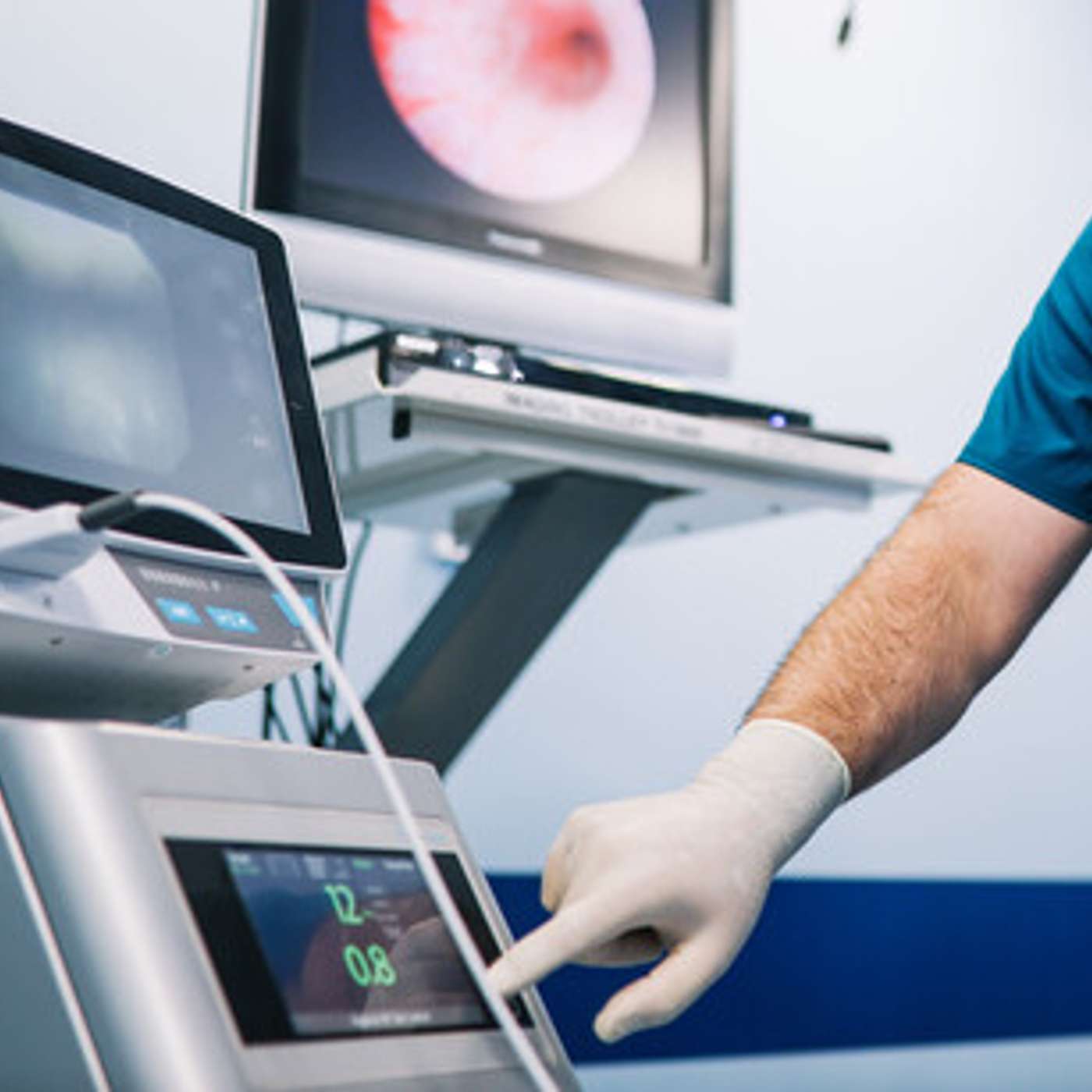 AI May Deskills Experienced Endoscopists, FDA Approves Brensocatib Treatment, New Blood Test Detects Virus, Maternal Obesity Linked to Autism, and more...