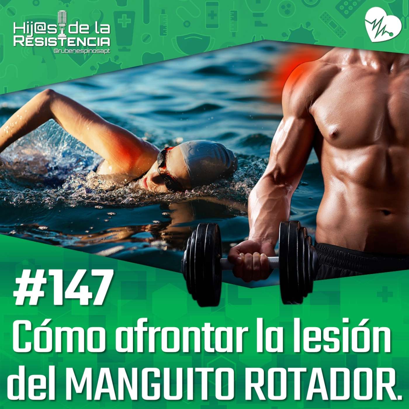 #147 Cómo afrontar la lesión del MANGUITO ROTADOR