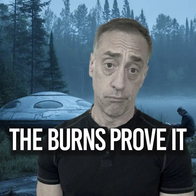 The Man Who Touched A UFO And Has The Burns To Prove It