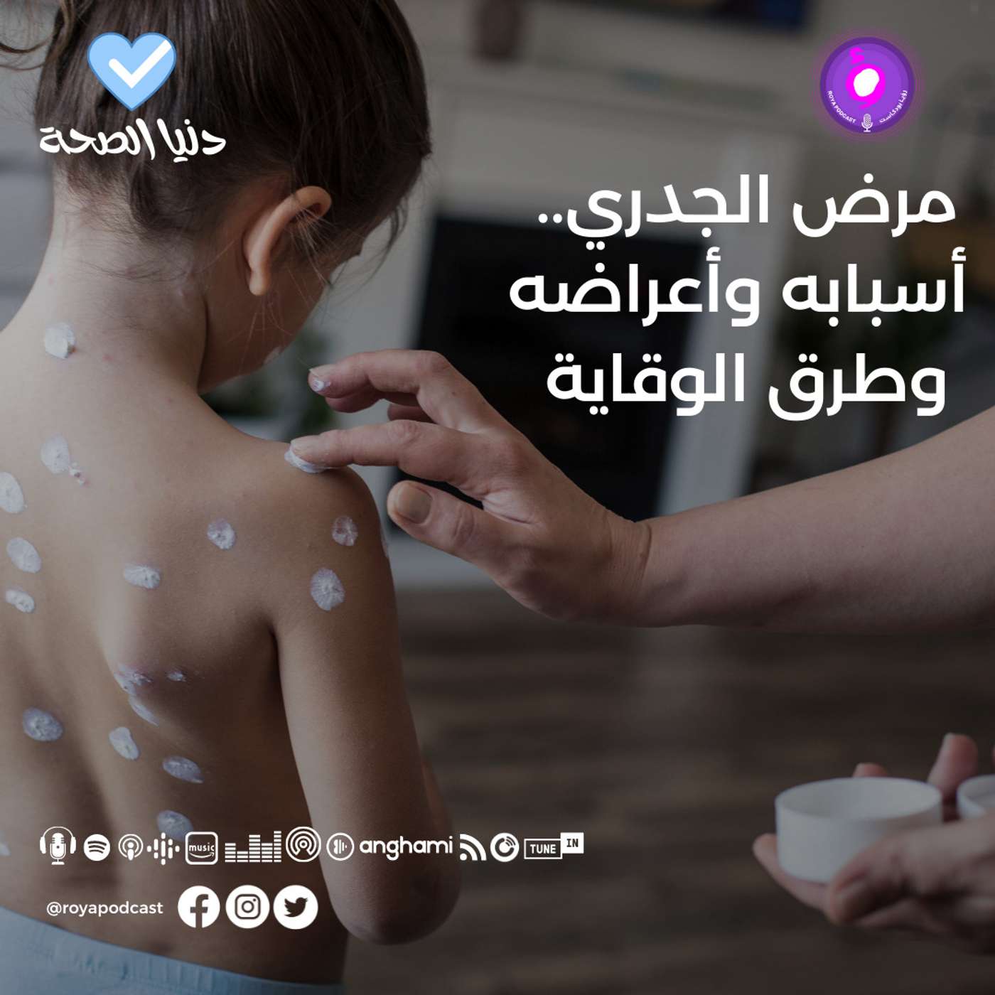 مرض الجدري.. أسبابه وأعراضه وطرق الوقاية