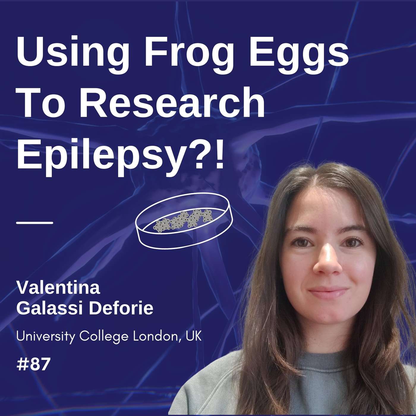 Using Frog Eggs To Research Epilepsy?! - Valentina Galassi Deforie episode artwork