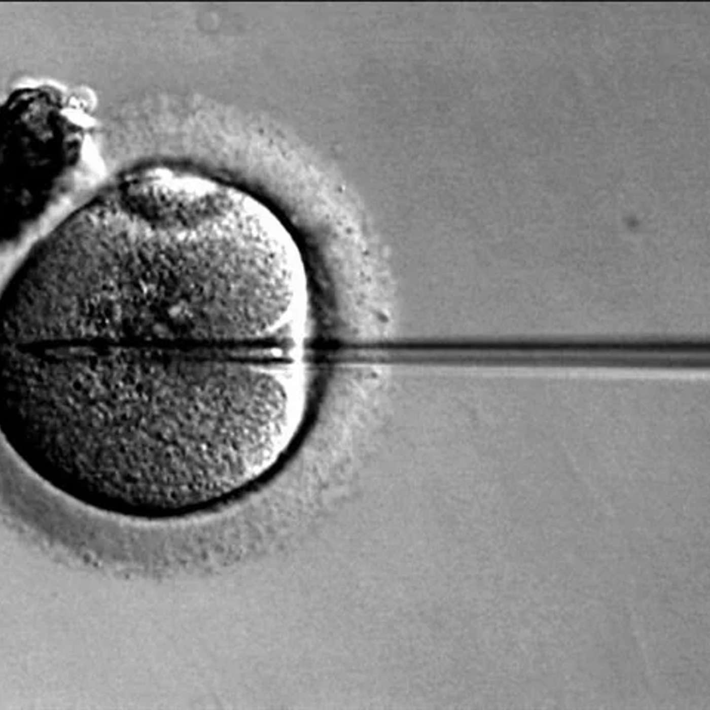 China and US Intensify Space Race, European Trees Display Resilience, Breakthrough Gene Therapy Targets Obesity, Breakthroughs in Sensor Nanomaterials, and more...