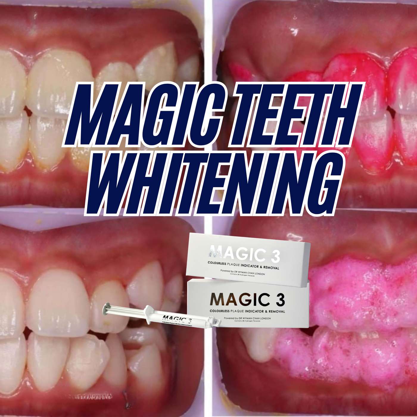 MAGIC Teeth Whitening with Dr. Wyman Chan – PDP245
