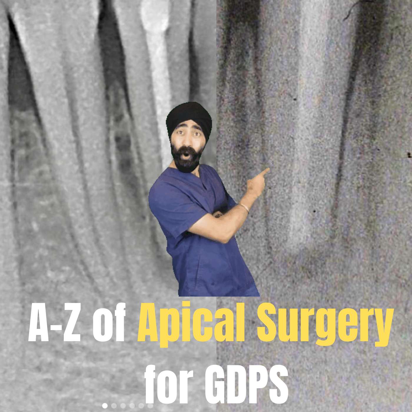 Apicoectomy Tutorial – When, Why and How – PDP148 episode artwork