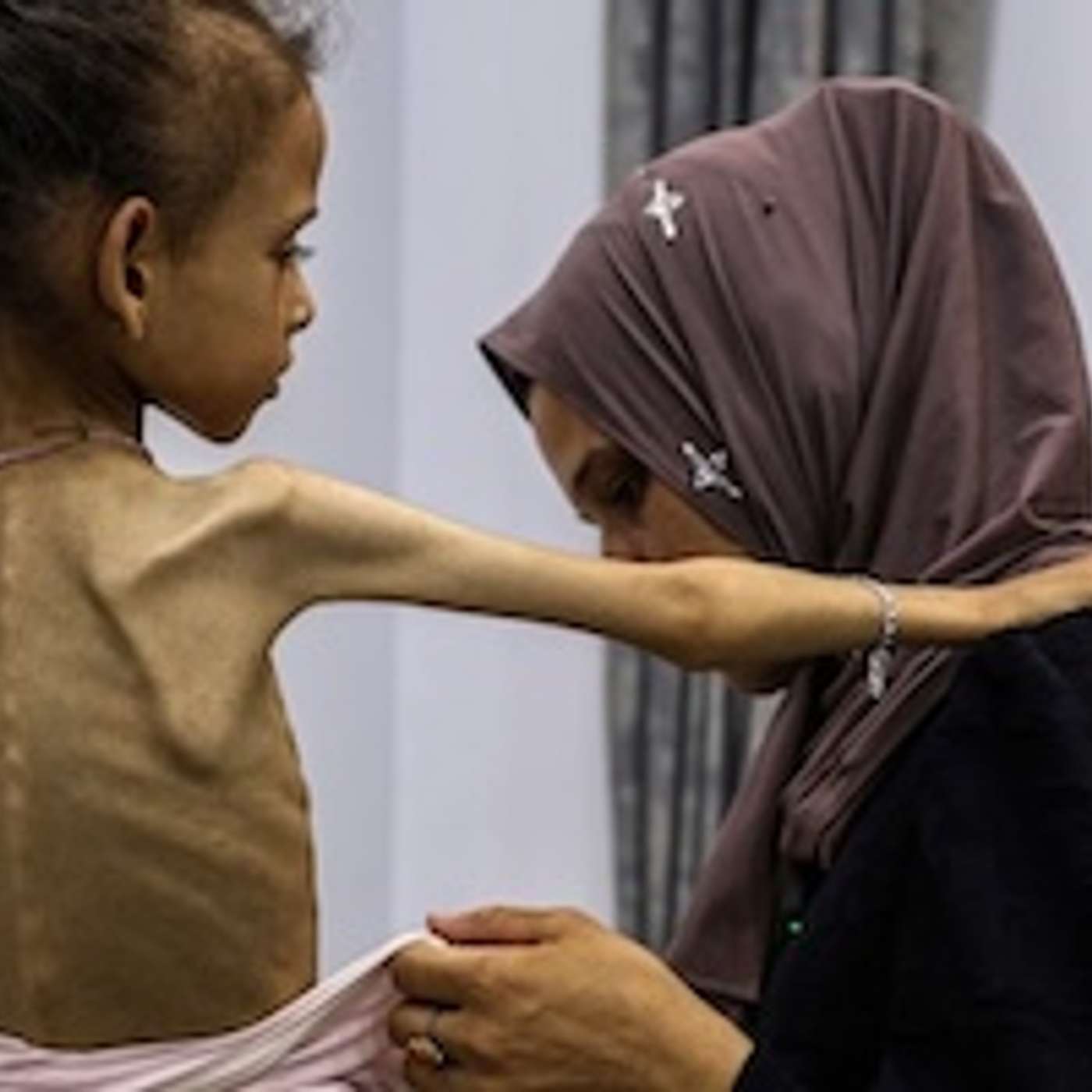 Israel’s Gaza Starvation Policy is Killing More Palestinians Every Day