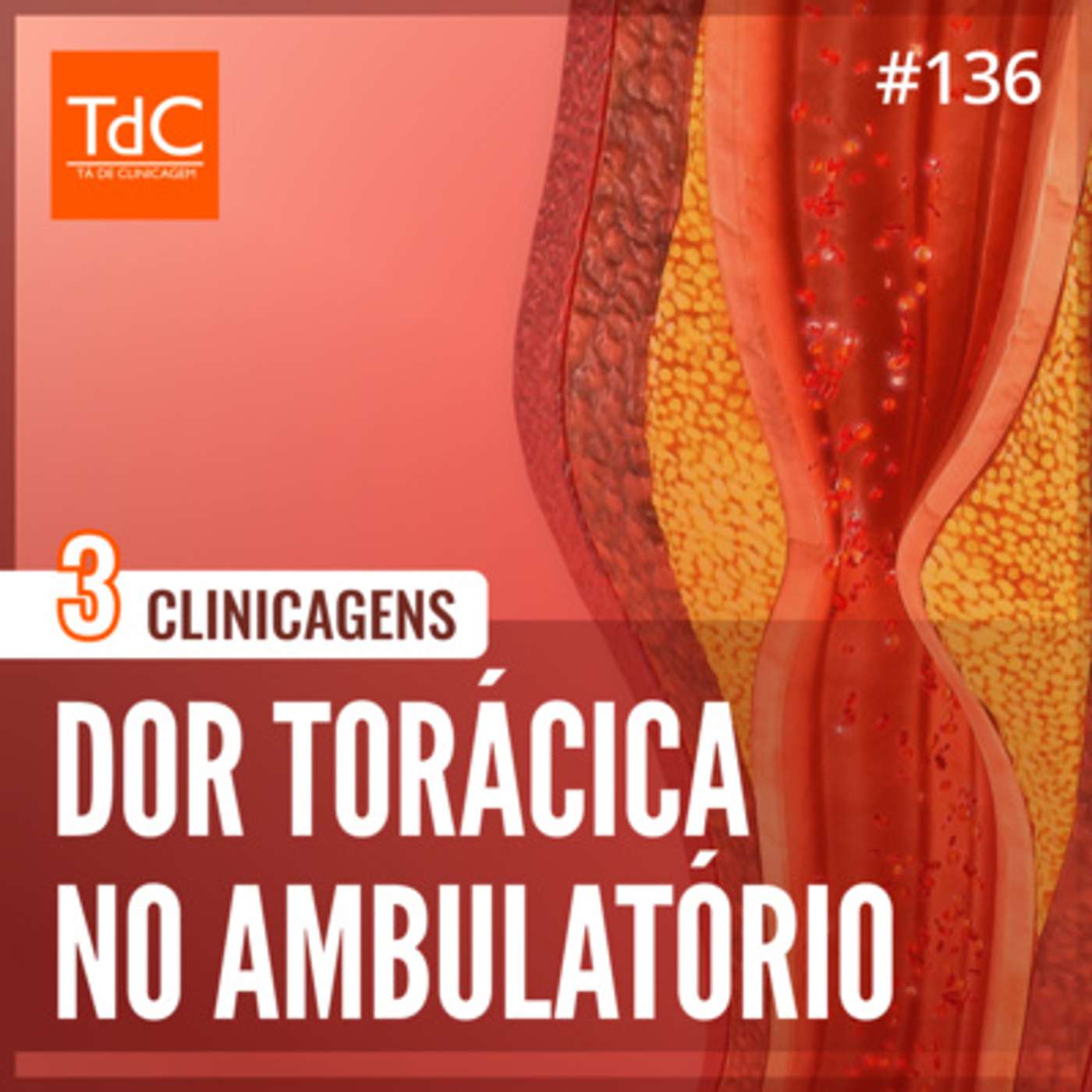 TdC 136: Dor Torácica no Ambulatório