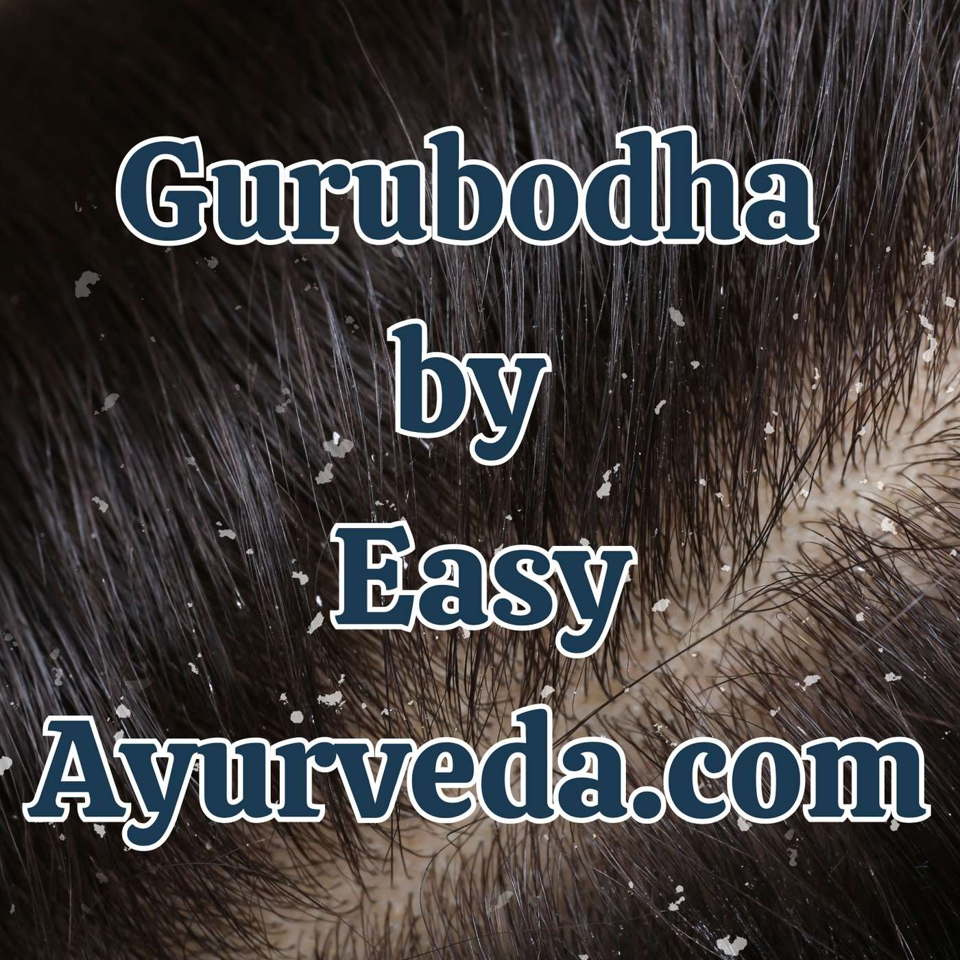 Gurubodha 141: Ayurvedic Anti-lice treatment| Seborrheic dermatitis Treatment | Anti-dandruff  Ayurvedic Shampoo’s| Dandruff Ayurveda Treatment episode artwork