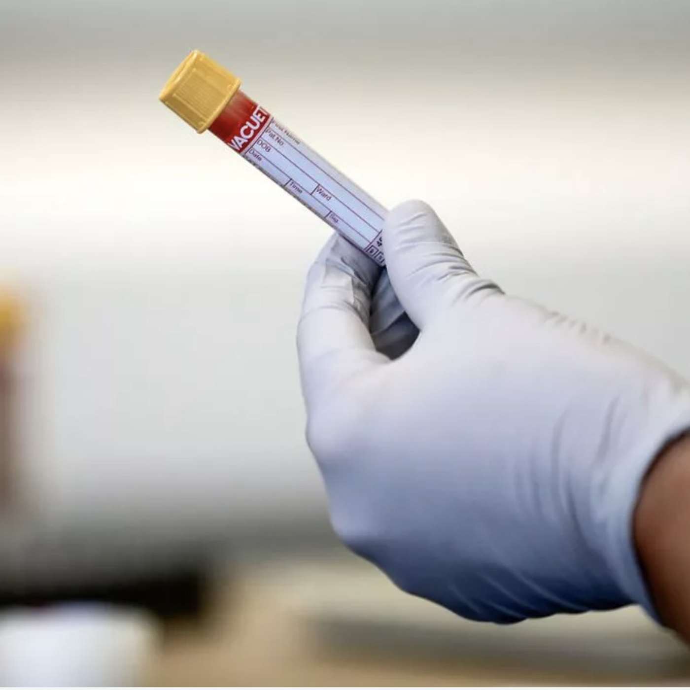 Ukraine War Halts Vital Arctic Research, Revolutionary Sepsis Blood Test Offers Rapid Diagnosis, Curbing the Surge of Vaccine Misinformation on Social Media, and more...