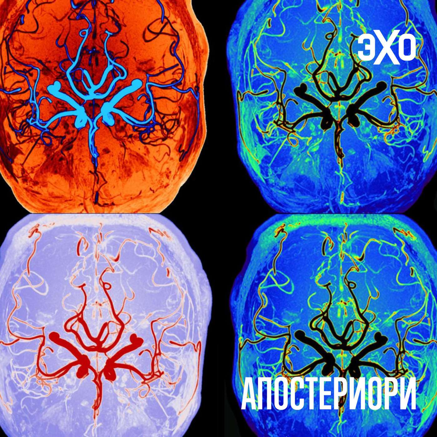 Учёные выяснили, что во сне мозг работает по другим правилам episode artwork