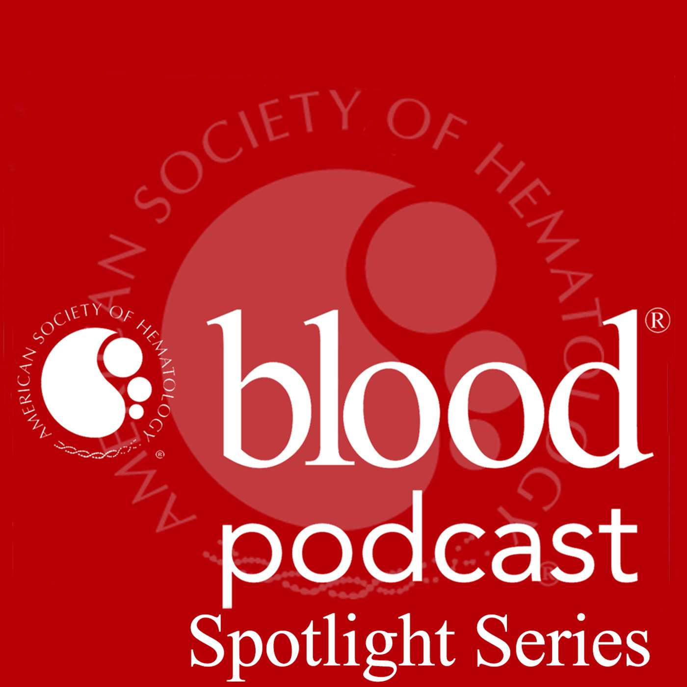 Spotlight on Acute Myeloid Leukemia