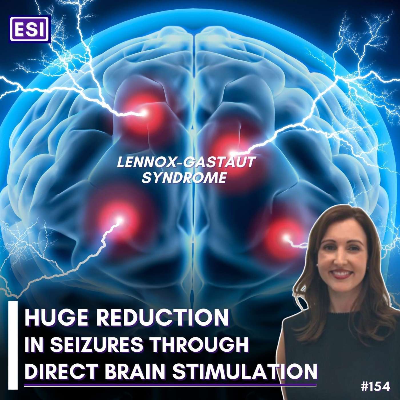 Huge Seizure Reduction Through DBS (in LGS) - Linda Dalic episode artwork