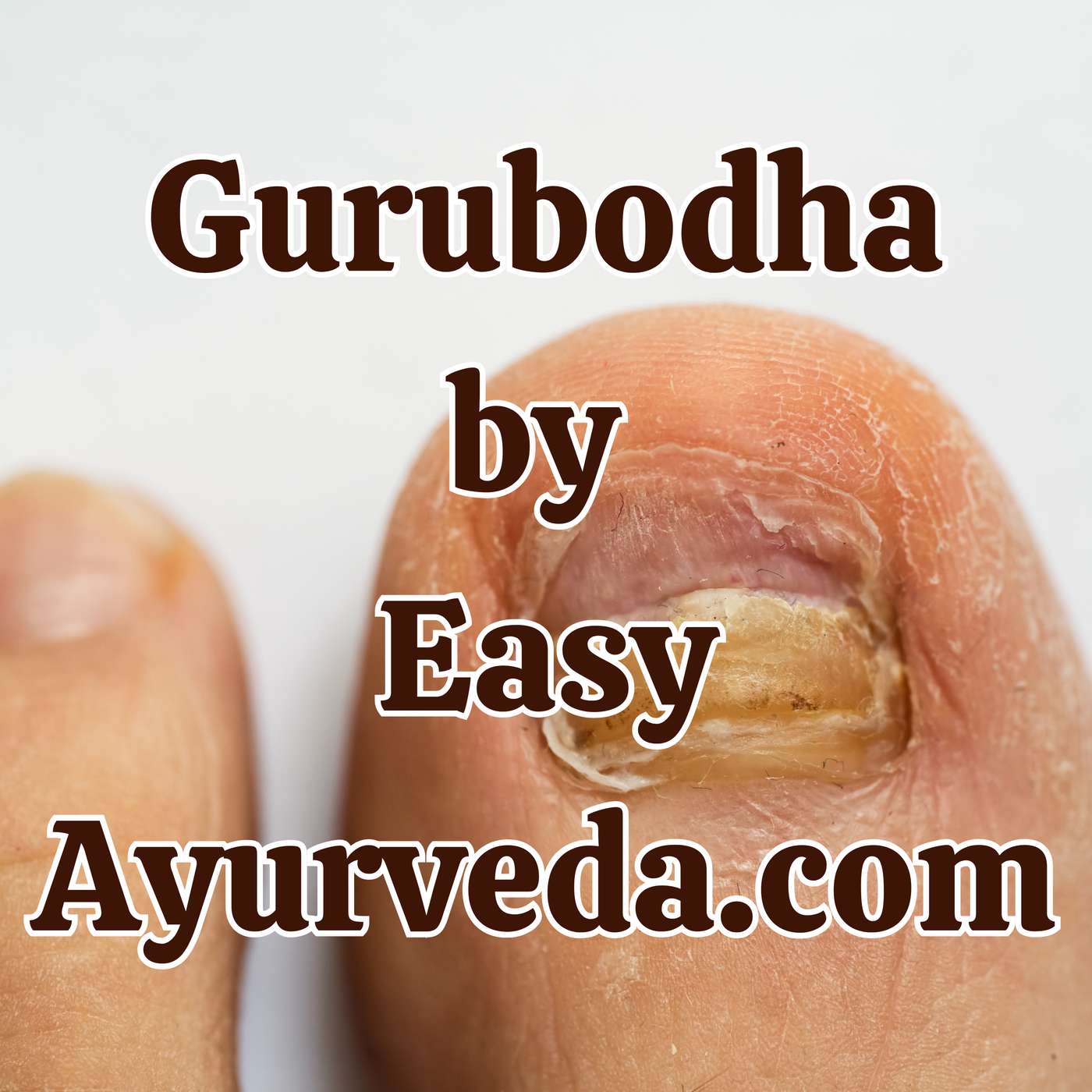 Gurubodha 185: Tonsillitis / Tonsile stones - Ayurveda perspective & Management| Toe fungal infection Management| Anulomana products