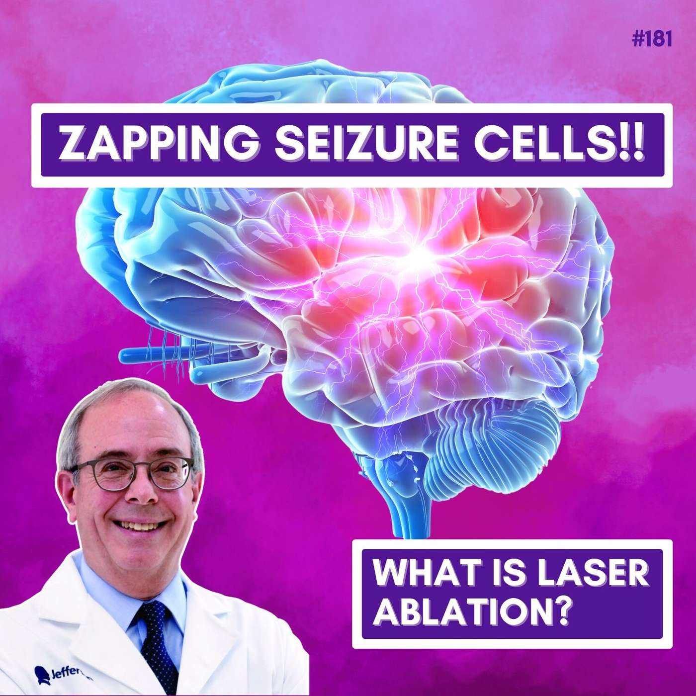 Laser Interstitial Thermal Ablation For Epilepsy - Michael Sperling episode artwork