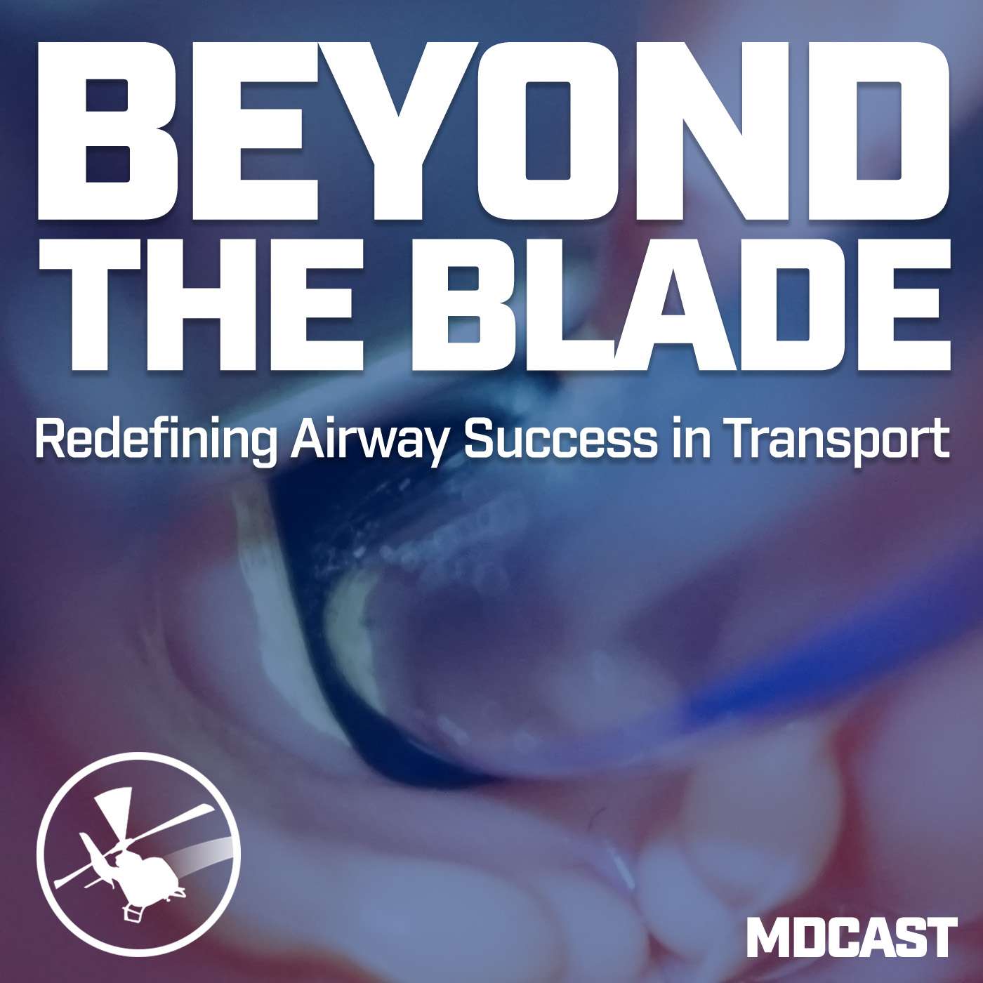 MDCAST: Beyond the Blade - Redefining Airway Success in Transport