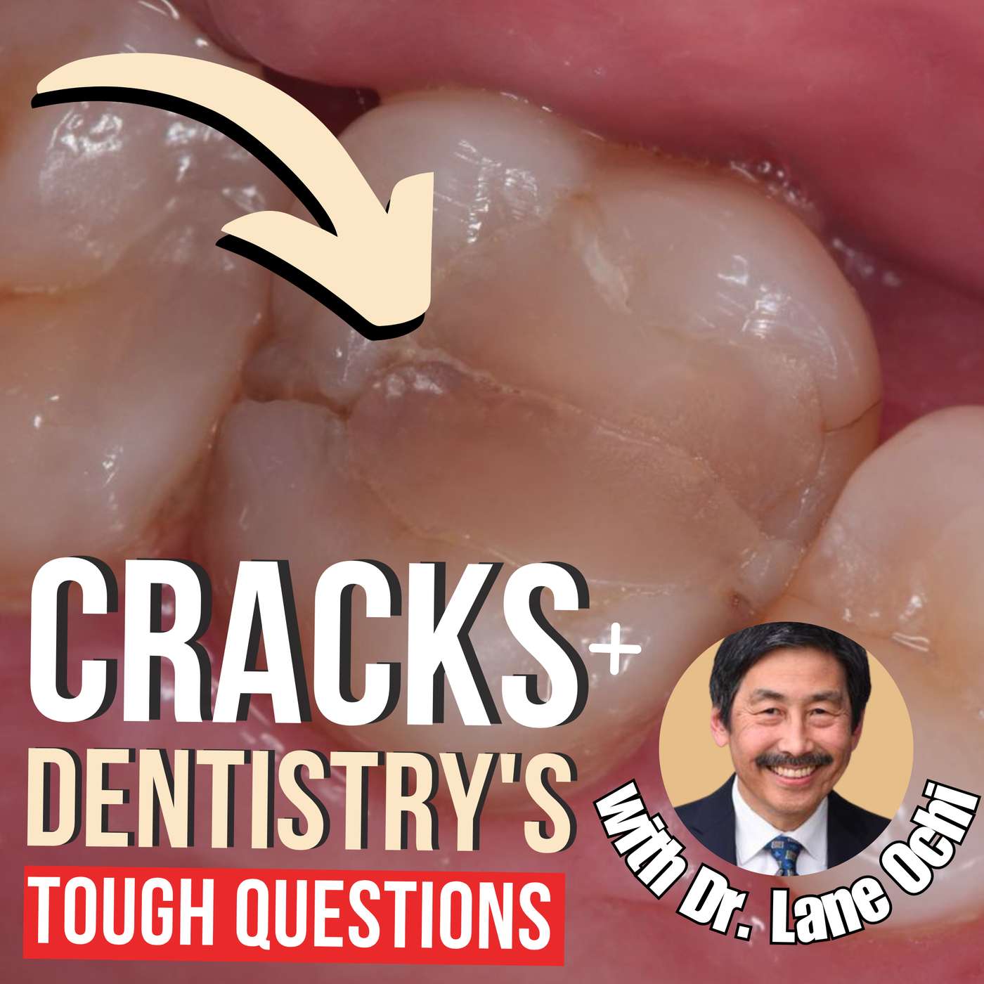 Cracked Teeth and Dentistry’s Tough Questions with Dr Lane Ochi – PDP175 episode artwork