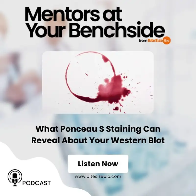 What Ponceau S Staining Can Reveal About Your Western Blot